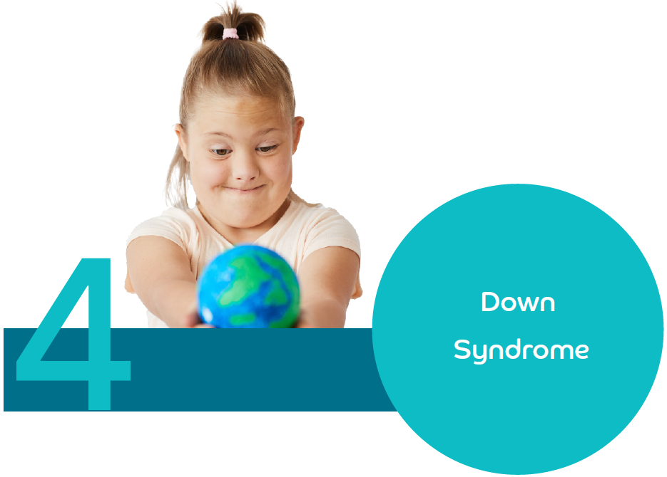  Down Syndrome